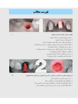 خرید کتاب زیبایی شناسی بافت نرم و پرسلن های صورتی رنگ | نشر اشراقیه