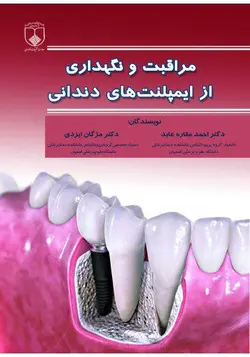 خرید کتاب مراقبت و نگهداری از ایمپلنت‌های دندانی | اشراقیه