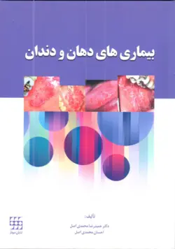خرید کتاب بیماری های دهان و دندان | نشر اشراقیه