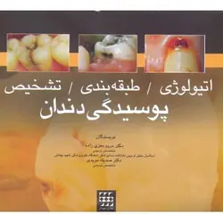 کتاب اتیولوژی/طبقه بندی/تشخیص پوسیدگی دندان | نشر اشراقیه