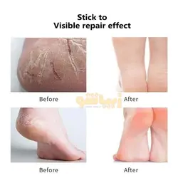 کرم کف پا درمانی معجزه گر روغن اسب جلیسا