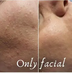 کوکتل ضدلک ژنو سویس