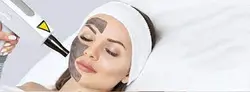 دستگاه لیزر کیوسوئیج