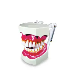 مولاژ دندان (تورم لثه )