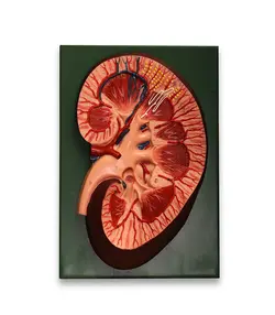 مولاژ کلیه انسان