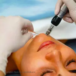 تراپی جوان ساز  FGF اکلادو