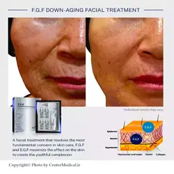 تراپی جوان ساز  FGF اکلادو