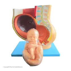 مولاژ حاملگی (جنین ۹ ماهه در رحم)