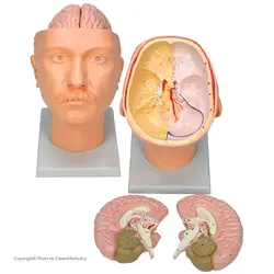 مولاژ سر با نمایش مغز و کف جمجمه