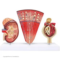 مولاژ کلیه سه تکه پلاستیکی (کلیه -نفرون-جسمک کلیوی)