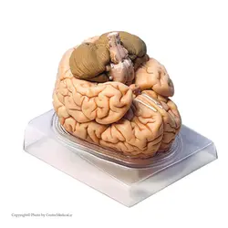 مولاژ مغز انسان 4 قسمتی