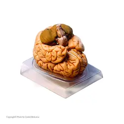 مولاژ مغز انسان با اندازه طبیعی(2قسمتی)
