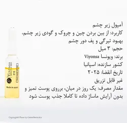 ویال دور چشم ویونسا ۳ میل