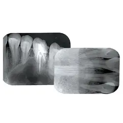 اسکنر فسفرپلیت اسمارت دنتافیلم - DentaFilm SMART Image Plate Scanner