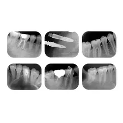 اسکنر فسفرپلیت اسمارت دنتافیلم - DentaFilm SMART Image Plate Scanner