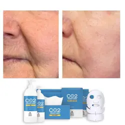 پک کربوکسی تراپی 25 نفره ریب اسکین 750 میلی لیتر