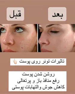 تونر پرتقال خونی بیواکوا ۵۰۰ میل