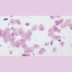 لام آماده میکروسکوپی برسر آلمان