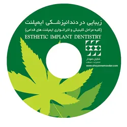 زیبایی در دندانپزشکی ایمپلنت CD-VCD