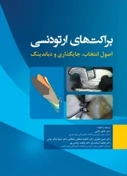 براکت های ارتودنسی اصول انتخاب، جایگذاری و دباندینگ