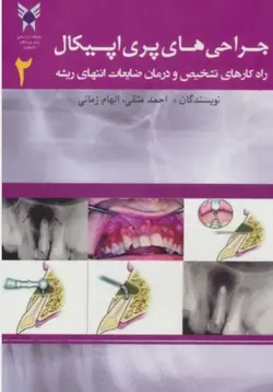 جراحی های پری اپیکال 2