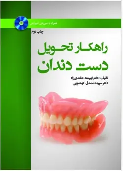 راهکار تحویل دست دندان