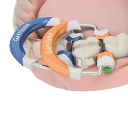 کلمپ (رینگ) سکشنال گریسون | Fussion Tight Molar - اسپایدنت