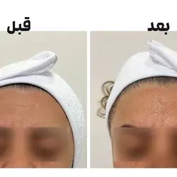 پک نخ کلاژن ساز و سرم جذبی برند ADAD