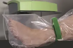 پکیج درمان زخم بستر درمان زخم دیابت - دی طب