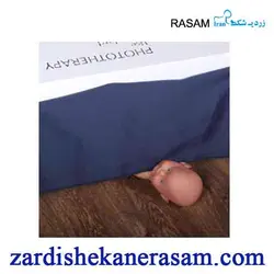 دستگاه زردی نوزاد مدل تاشو TL.1003