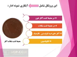 پاورپوینت میکروبیوم های دستگاه ادراری – روش ها، توالی، عفونت، سرطان و …