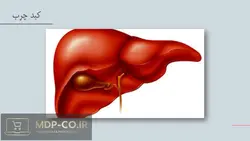 پاورپوینت کبد :  ارزیابی آسیب و بیماری ها ، تست عملکرد ، آلبومین ، بیلی روبین و …