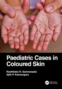 Paediatric Cases in Coloured Skin 1st Edition - موسسه آموزشی نوآوران دانش - دوره های پزشکی و آزمون دستیاری