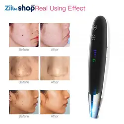 دستگاه لیزر قلمی نتسل سری جدید پاک کننده تاتو و از بین بردن ضایعات پوستی LESCOTON