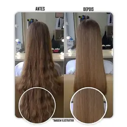 بوتاکس لونیکس ماندیوکا