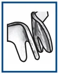 کلمپ آناتومیک MD RING