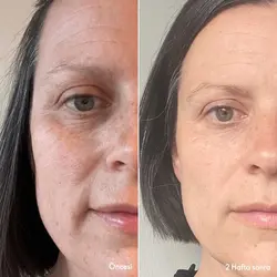 ست ضدچروک و کلاژن ساز نوایج پلاس (43695)