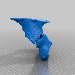 شکستگی استابولوم (acetabulum fracture)