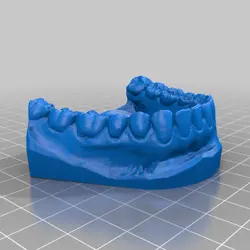 مولاژ دندان (dental model)