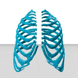 مولاژ دنده (rib cage)