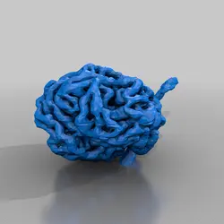 مولاژ گلومرول کلیه (glomerulus)
