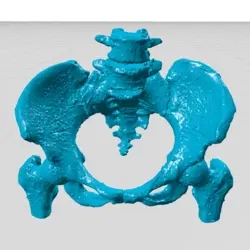 مولاژ لگن به صورت یکپارچه و جدا از هم (pelvic)