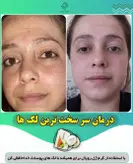 پکیج کرم و صابون رویال