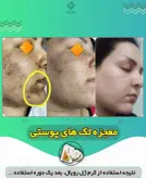 پکیج کرم و صابون رویال