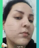پکیج کرم و صابون رویال