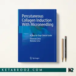القای کلاژن از راه پوست با میکرونیدلینگ Percutaneous Collagen Induction With Microneedling
