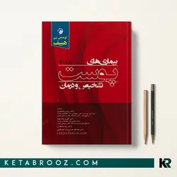 تشخیص و درمان بیماری های پوست هبیف