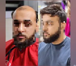 پوستیژ کف سرمردانه آنکارایی طبیعی (کد:14095)