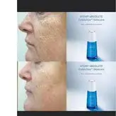 آمپول( سرم) درمانی کلاژن ساز ، ضدچروک و ضدپیری اتمی