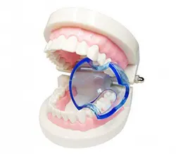 دهان بازکن خلفی – سامان زر دندان
